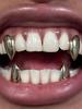 Personalized Tooth Decoration: Smooth Surface, Small Tiger Teeth, Pointed Teeth, Upper And Lower Tooth Decoration, Funny Vampire