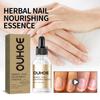 Nail Care Oil Hand & Foot Moisturizing Care Thickening Nail Gray Nail Ingrown Nail Shine Nail Oil