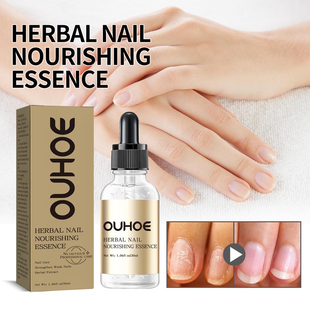 Nail Care Oil Hand & Foot Moisturizing Care Thickening Nail Gray Nail Ingrown Nail Shine Nail Oil