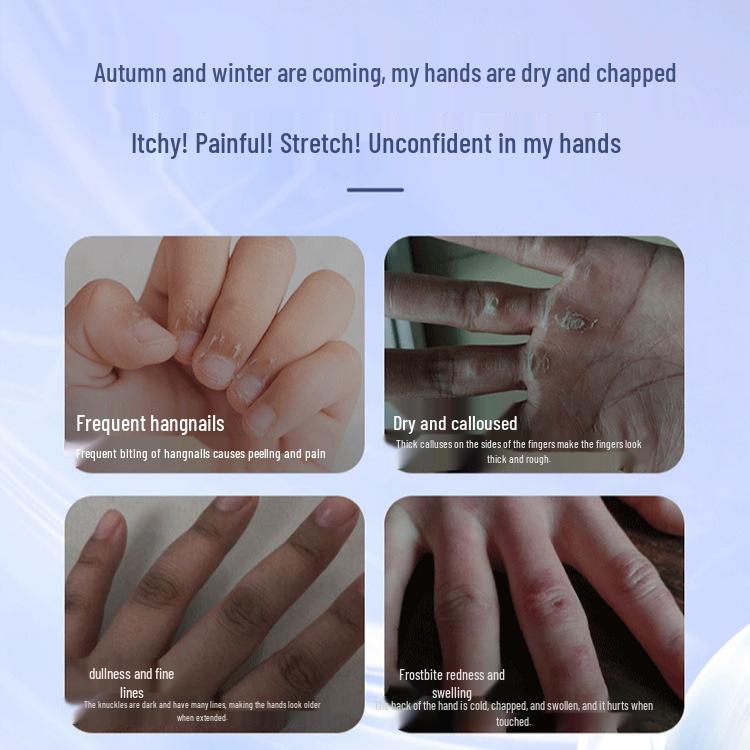 Ge Bao Lian White Vaseline Hand Cream for Men & Women: Anti-Cracking, Moisturizing, Non-Greasy, Ideal for Autumn/Winter, Large Bottle.