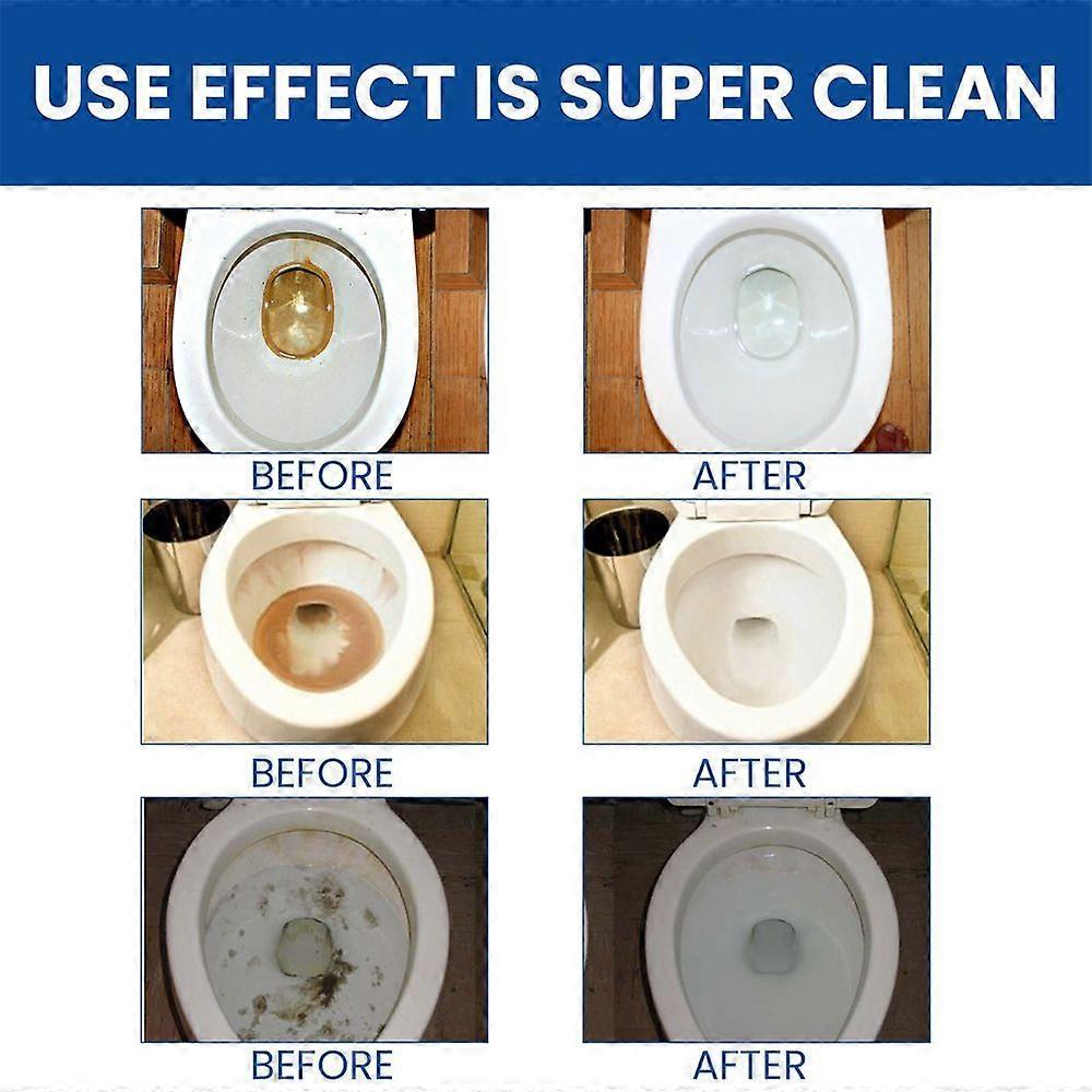 3boxes Toilet Decontamination Effervescent Tablets To Remove Scale And Urine Stains Toilet Cleaner Deodorant Strong