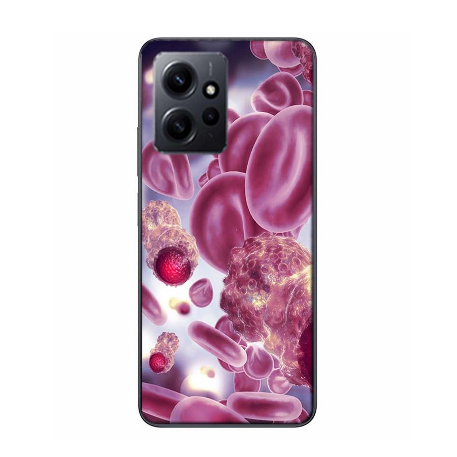 

Blood Platelets Under Microscope Phone Case For Redmi 12 13C 12C 15C 9 10 10C Note 13 Pro Plus 14 15 Pro 9T 9C 9A TPU Soft Cover Redmi Note 14 Pro 4G