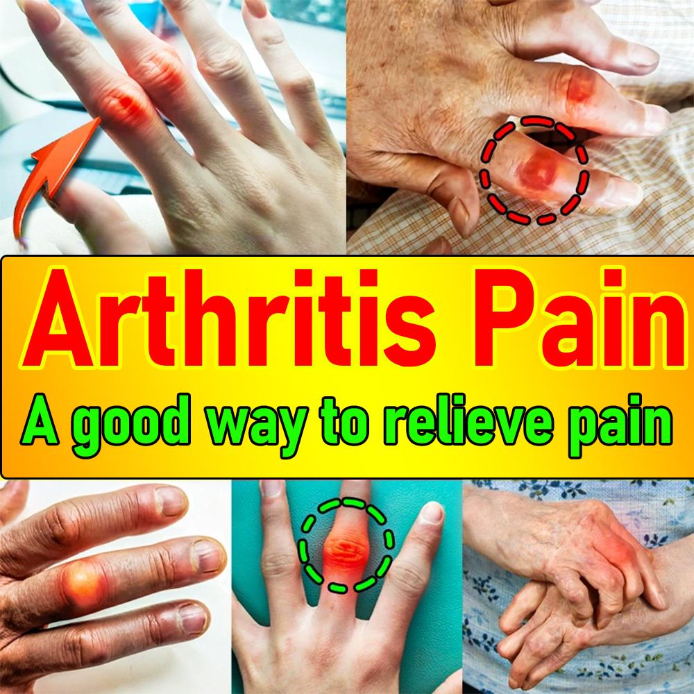 Pain Relief Cream Formulated Specifically for Finger Arthritis