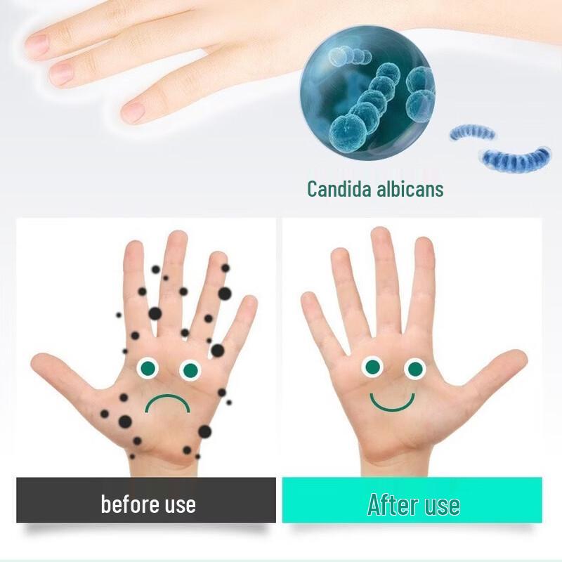 Haishi Hainuo 75% Alcohol Hand Sanitizer Gel - 5 x 60ml Portable Bottles