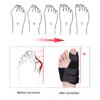 Toe Corrector Orthotics Bone Thumb Adjuster Hammer Protector Hallux Valgus Corrector Bunion Corrector Orthopedic Tool Care Tool