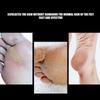 Wear-Resistant Foot Nail Drill Bit Durable Callus Sanding Head  Foot Skin Maintenance