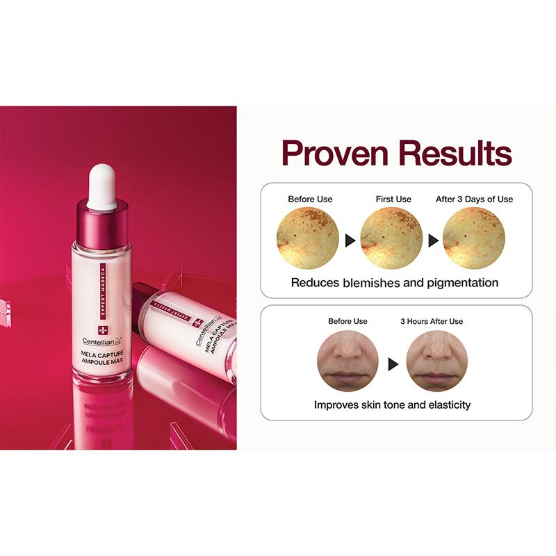 CENTELLIAN24 Expert Madeca Mela Capture Ampoule Max 45ml – Coreean, Ser Iluminator și Anti-Rid cu TECA și Complex Gluta-C™