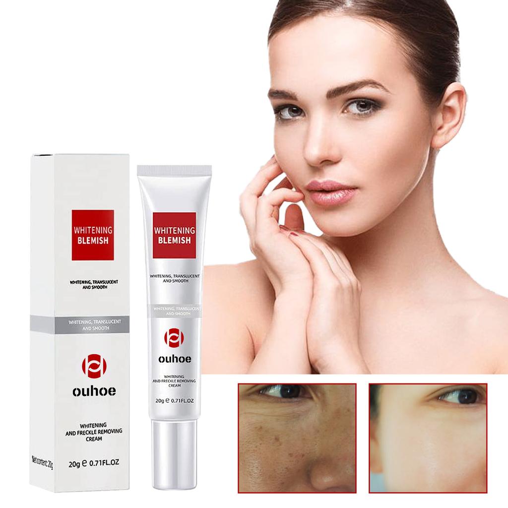 Black Spot Removal Cream, Moisturizing And Repairing, Fading Facial Fine Lines And Spots, Melanin Hydrating And Whitening Skin