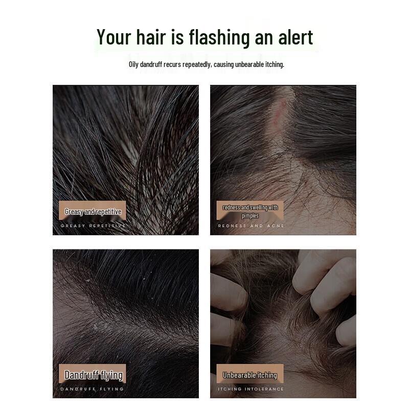 100 Years Runfa Anti-Breakage & Smoothing Shampoo Set