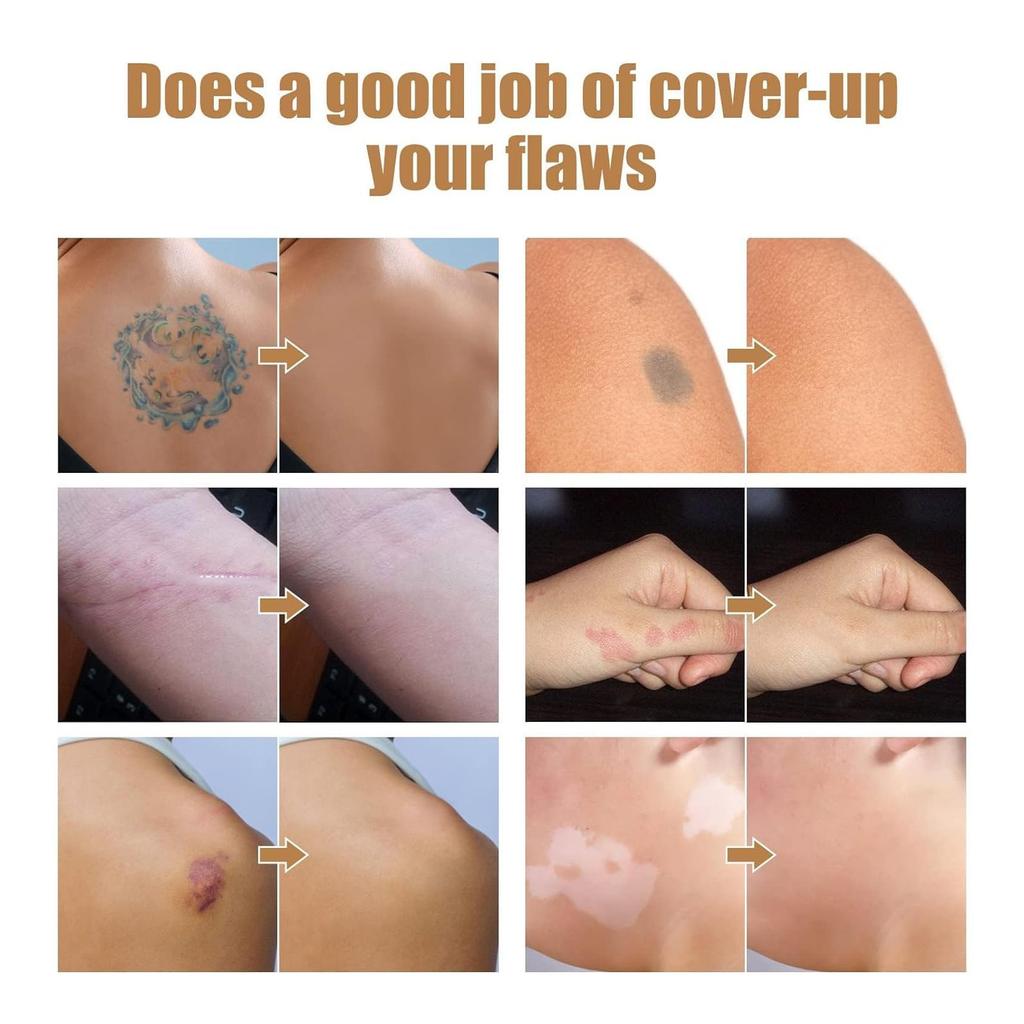 Dark Spots Cover Up 2 Colors Makeup Waterproof Sweatproof Cover Up Skin Concealer Set Long Lasting Suitable For Dark Spots Vitiligo