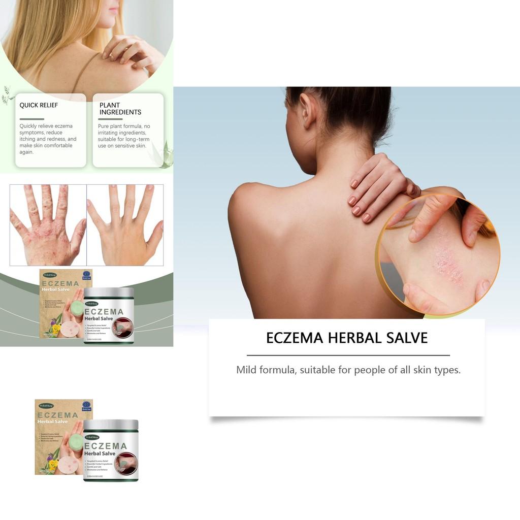 Woodsleep Herbal Cream Natural Formula For Soothing Skin Redness And Bumps