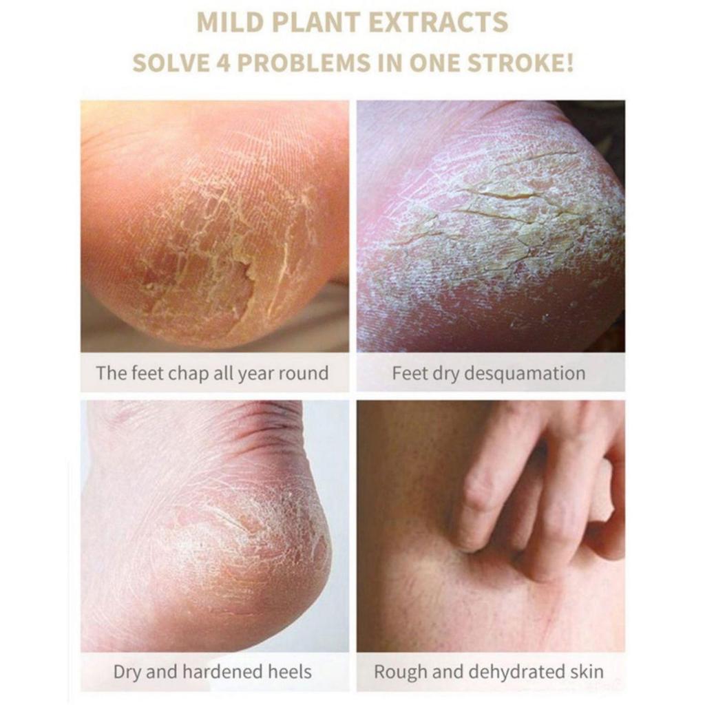 Foot Care Cream for Dry and Crack Heels, Foot Moisturizer for Repair Cracked Hands, Feet and Skin