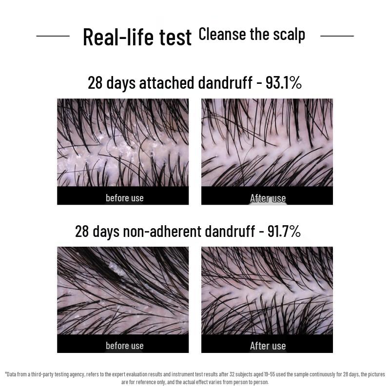 Fama21 Anti-Dandruff Shampoo & Conditioner Set