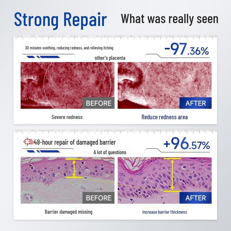 Naseki Oligopeptide Freeze-Dried Skin Repair Kit