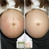 Pregnant Women's Belly Line Cream for Preventing Postpartum Pregnancy Lines Repair Cream