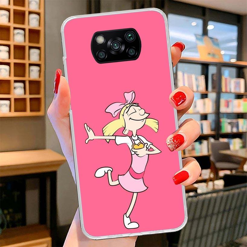 Cartoon Hey Arnold Fondos Cover Phone Case For Xiaomi Poco F7 Ultra X7 X6 X5 Pro M7 Redmi 15C 15 13C 13 12C 12 10C 10 9A 9C 9T 9