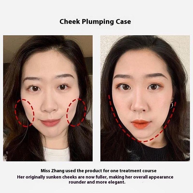 Fengying Elasmizing Essence Fills Apple Muscle Fengface Essence Huafeng Forehead Tear Groove Lifting