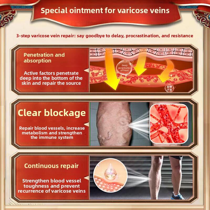 Herbal Varicose Veins Ointment - Relieves Tension Natural & Skin-Friendly