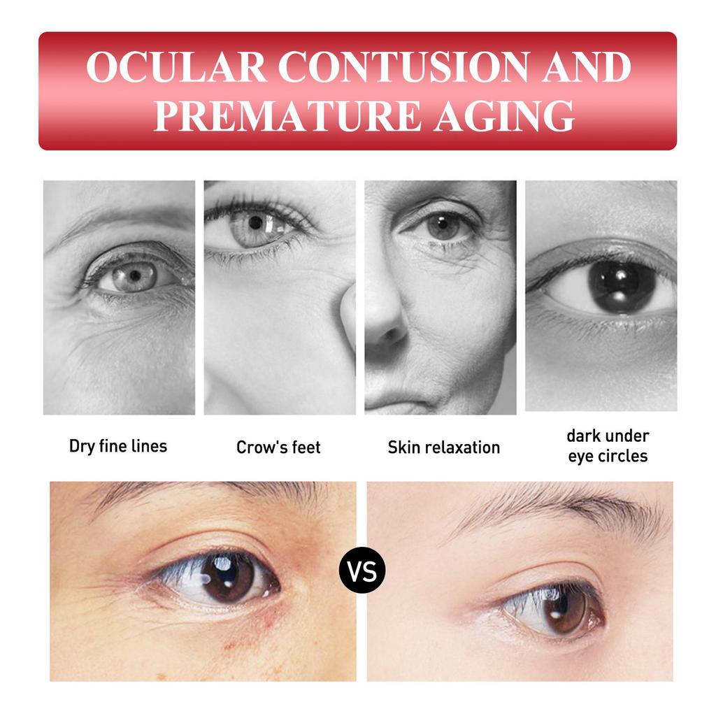 West&Month Propolis Anti-Wrinkle Eye Cream, Moisturizes Eyes, Reduces Fine Lines and Dark Spots, Firms and Brightens, Removes Milia 30g