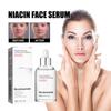 EELHOE Niacinamide Face Serum Whitening Anti Wrinkles Removal Spots Freckle Face Care Sodium Hyaluronate Facial Essence 50ml
