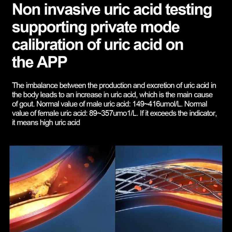 2025 Noul Ceas Inteligent Precis pentru Lipide Sanguine Bărbați Femei ECG+PPG Tensiune Arterială Apel Bluetooth Ceas Inteligent pentru Sănătate