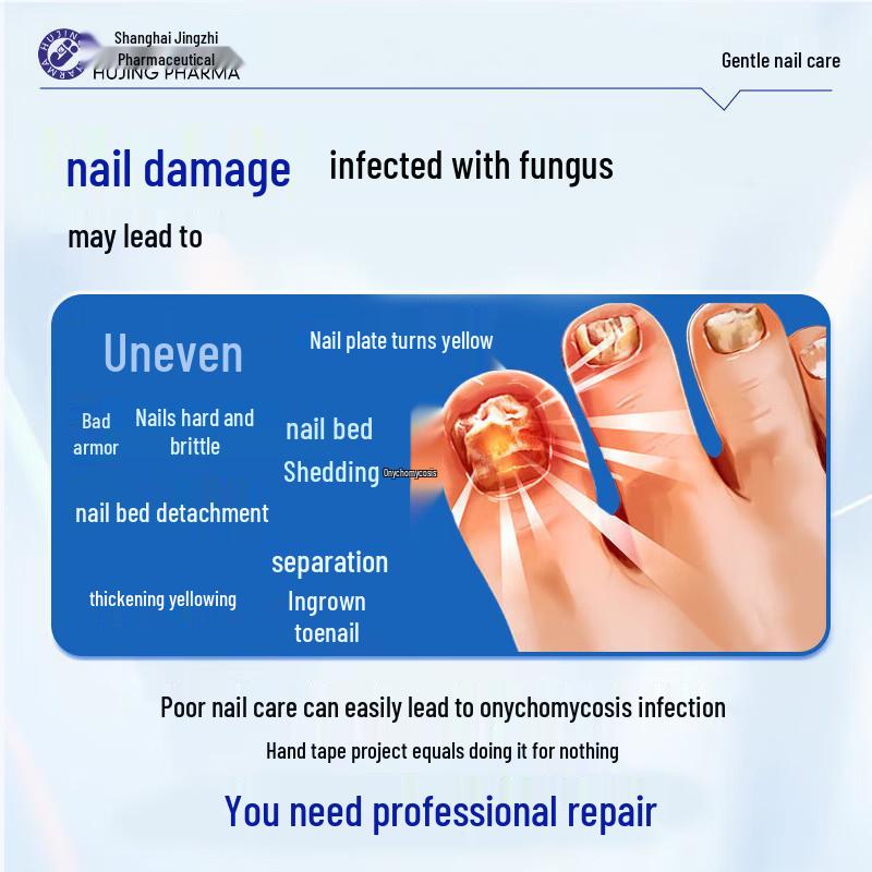 Nail Fungus Treatment Solution