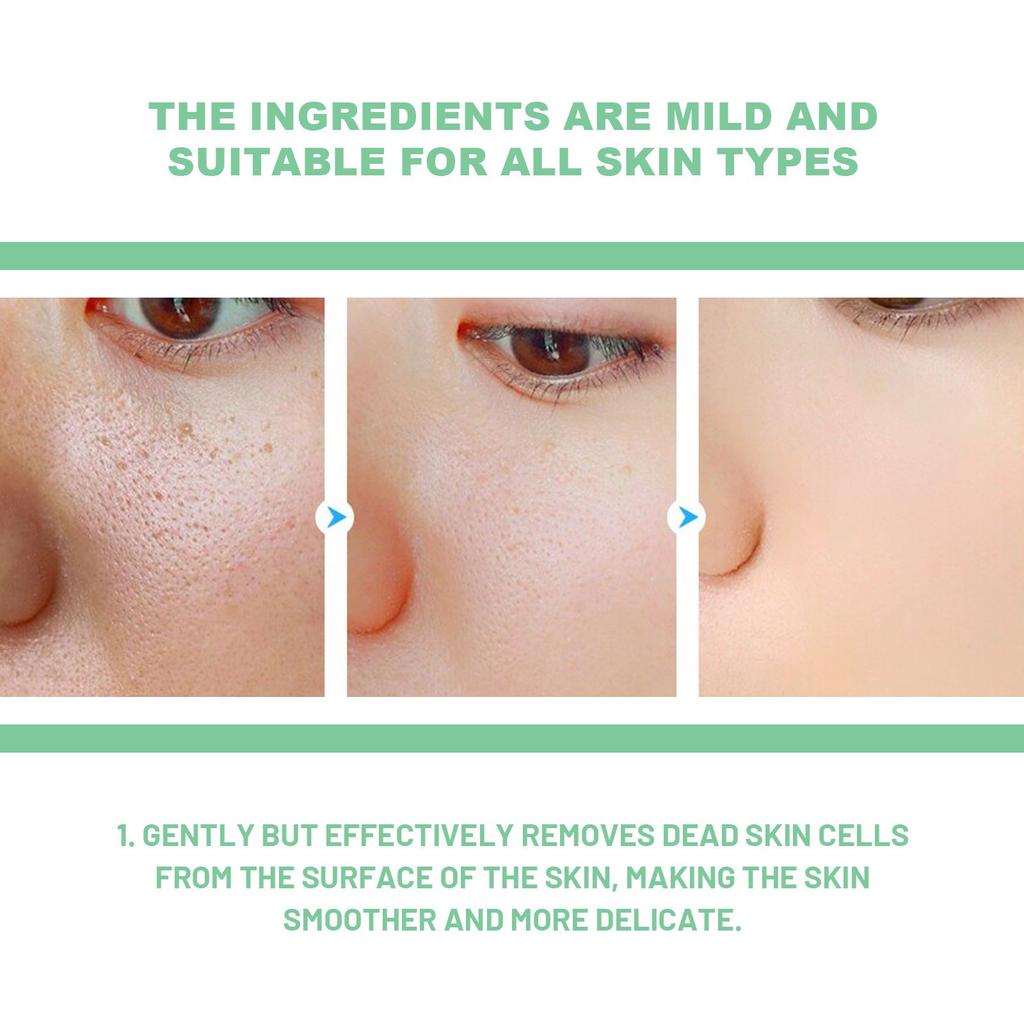 Herbal Exfoliating Gel Mildly Cleans Closed Mouth And Black Mouth, Shrinks Pores, Exfoliates And Brightens Skin Gel