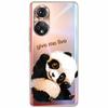 Clear Soft TPU Cover For Honor 50 Pro Lite Case Honor70 5G New Silicone Transparent Funda for Huawei Honor 70 5G Honor50 Coque