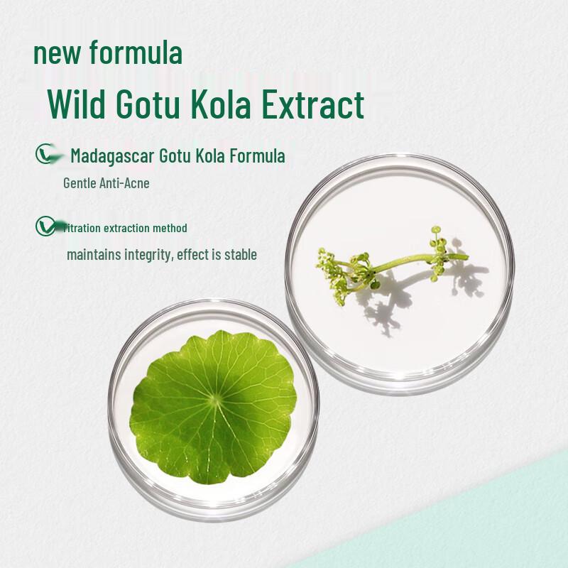 Mentholatum Acnes Anti-Acne Oil Control Toner 150ml