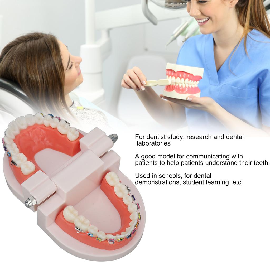 Dental Typodont Teeth Model with Orthodontic Metal Bracket for Dentist Teaching Research Dental Laboratory