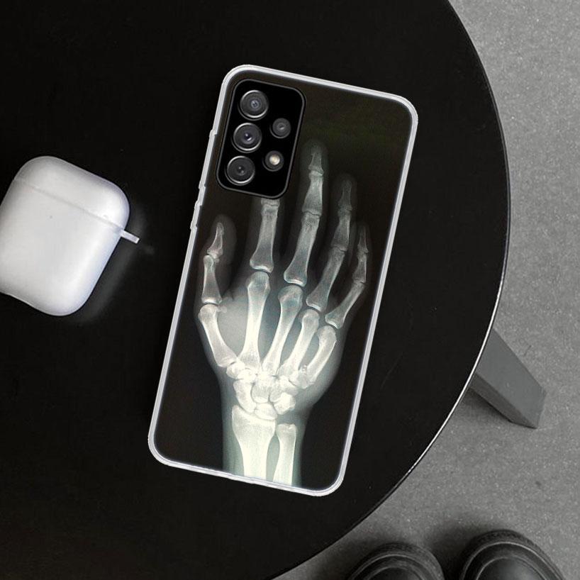 Autumu X Ray Hand Bones Phone Case Cover for Samsung Galaxy A12 A22 A32 A52 A72 A02S A51 A50S A31 A20S A10S Note 20 Ultra 10 Plu