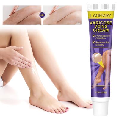 Varicose Veins Cream-Relief Phlebitis Angiitis-Promote Blood Circulation-Repair Skin Elasticity-Suitable For All Skin Types, 20g