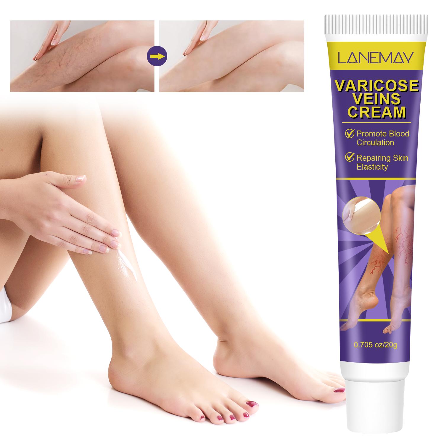 

Varicose Veins Cream-Relief Phlebitis Angiitis-Promote Blood Circulation-Repair Skin Elasticity-Suitable For All Skin Types, 20g