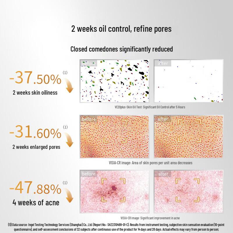 Fu Er Jia Lactobionic Acid Serum