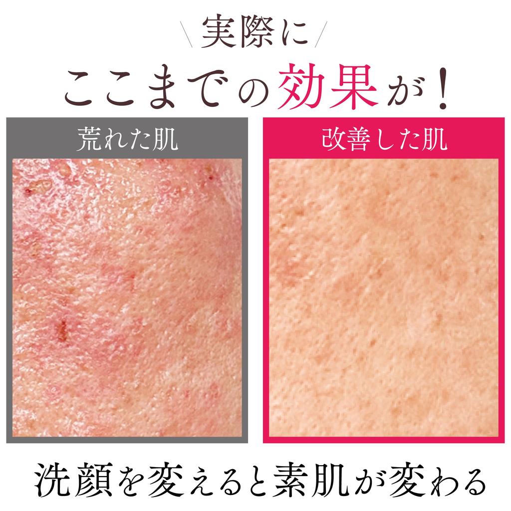 GOODSKIN Solid Facial Skin Pore Dryness and Damage Mineral Rich Foaming Face Wash Strawberry and Supply Men's Cleanser, Additive-Free, Care,