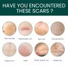 EELHOE 1 Roll Silicone Scar Removal Sheets for C-Section Postoperative Skin Colored Invisible Beauty Tape