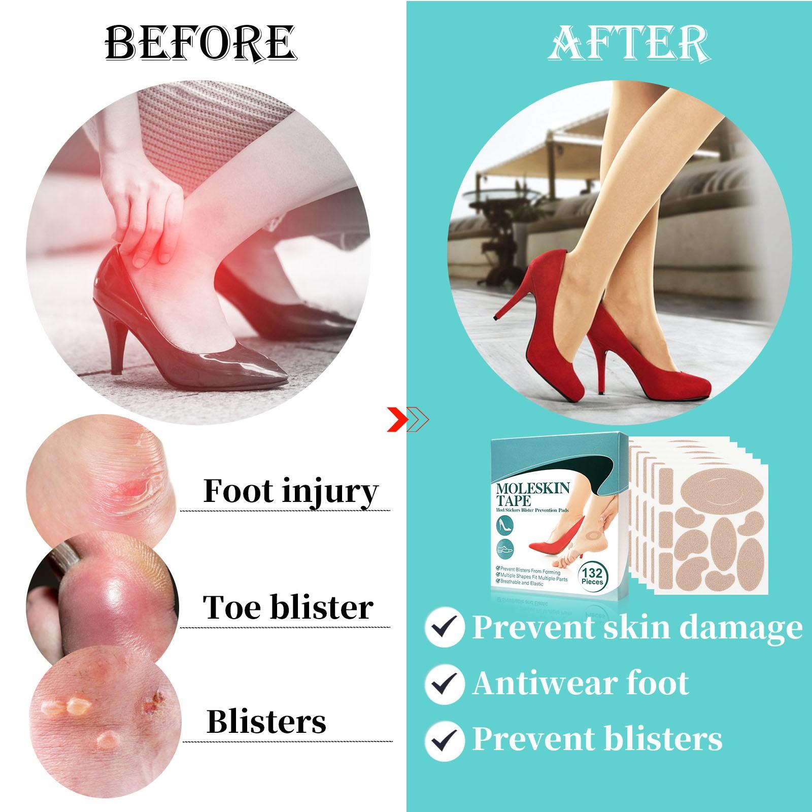 Антифрикционная лента для стопы — фото 2