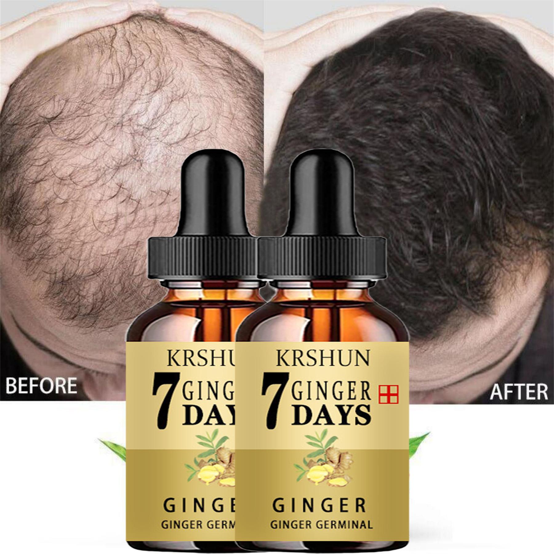 

Рост волос стал проще с сывороткой для волос Eelhoe Ginger — уход за волосами с добавлением женьшеня и имбиря для полных волос