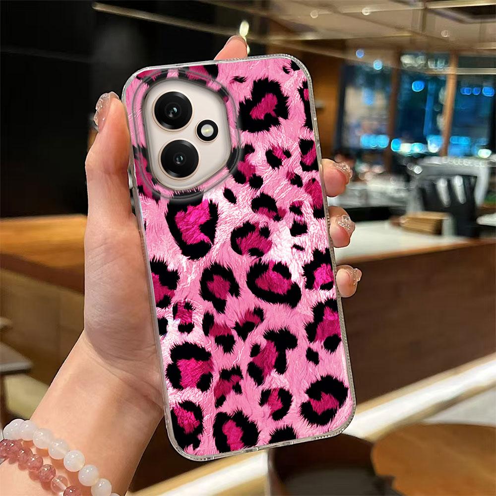 Color Tortoiseshell Amber Glossy Phone Case for Honor 400 200 90 Smart Pro Magic7 70 Lite X9a X9c X9b X8b X8a X8c X7c X7b Cover