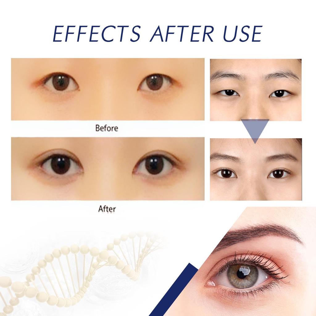 EELHOE Double Eyelid Cream - Seamless, Invisible, Natural, Long-Lasting, Waterproof, Lightweight, Quick-Dry, Big Eye Beauty.