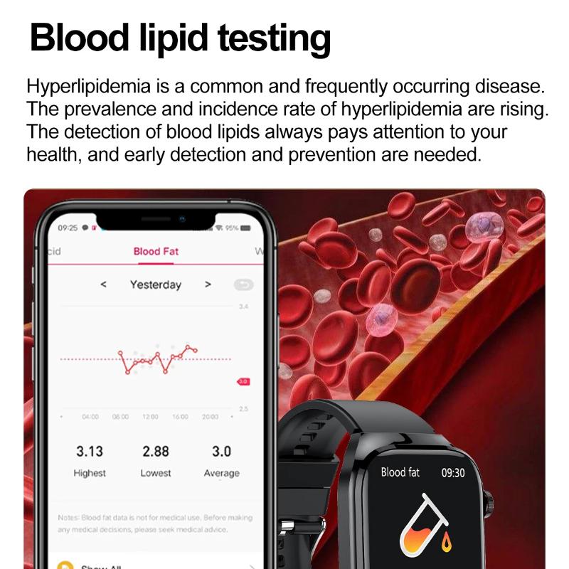 2025 Nye AI Laserdiagnose Helse Smartklokker Menn EKG+PPG Blodlipider Urinsyre Hjertefrekvens BT Sport Anrop Smartklokke