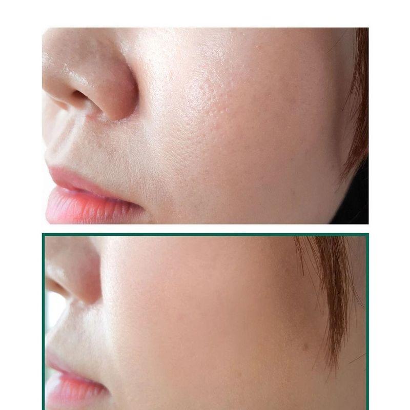 SOME BY MI - AHA,BHA,PHA 30 Days Miracle Acne Clear Foam Mini