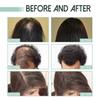Revitalize Hair Growth Serum with Ginger & Plant Extracts  Nourishing Scalp Treatment for Thicker, Stronger Hair, Reduces Hair Loss & Promotes Natural