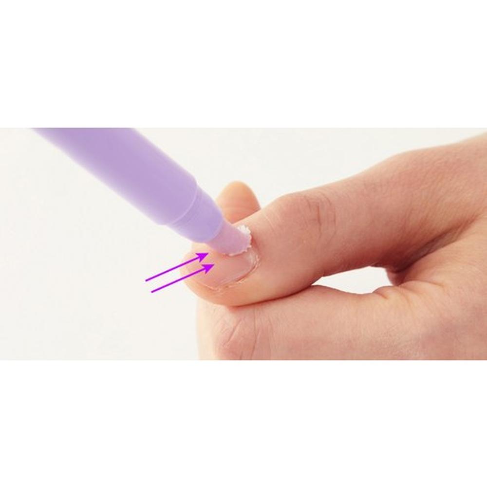 Dr. wonder Keramik-Taschen-Nagelhautentferner 1,5g