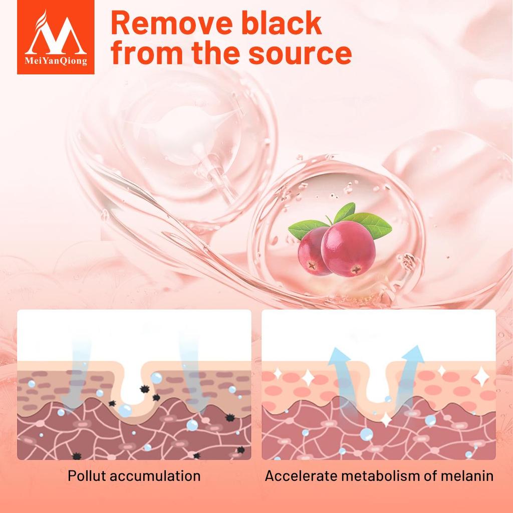 MeiYanQiong Bright Skin Cream Improve Dark Freckles 40g
