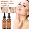 5ML/15ML/30ML/50ML/TRSTAY Effective Whitening Freckle Cream Remove Dark Spot Face Cream Removal  Melasma Lighten Brighten Smooth Skin Care