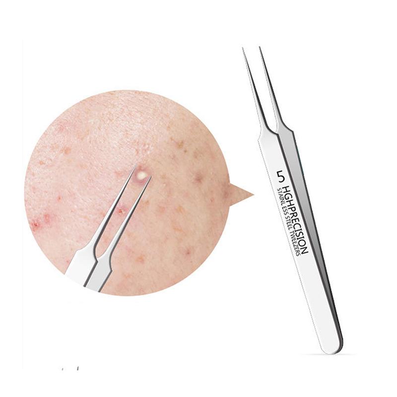 Blackhead Remover Tweezers Stainless Steel Pimple Remover Tweezers Precision Pimple Popper Tool Cell Clip For Skin Purification