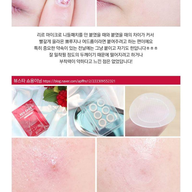 RiRe - Red Spot Micro Needle Patch