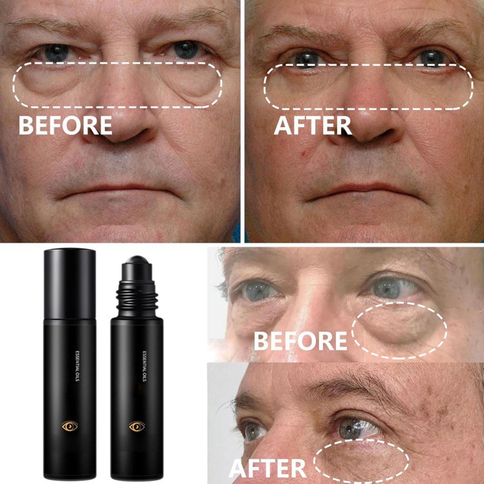 

Retinol -wrinkle Eye Serum Oil, Eye Roller Oil, Reduce Fine Lines, -wrinkle Eye Serum One Size