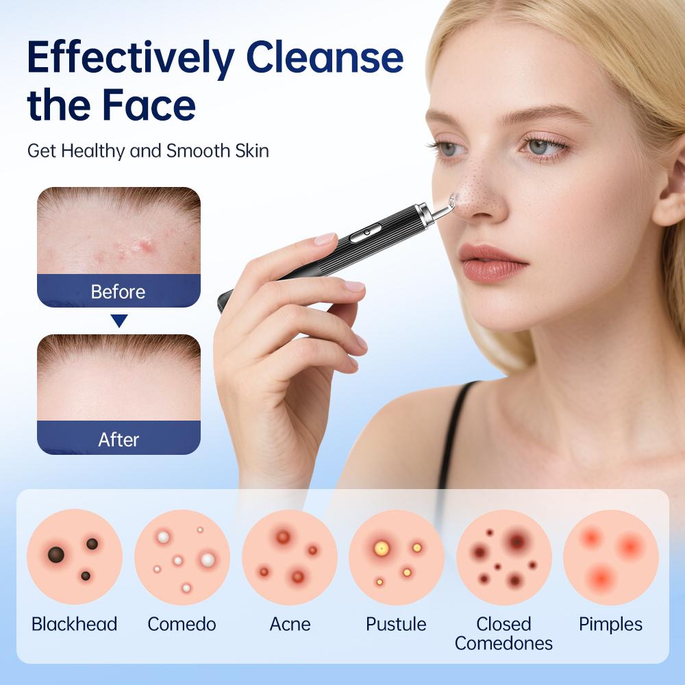 Visual Blackhead Remover HD Camera Facial Deep Clean Machine Acne and Pore Remover Face Extractor Electric Blackhead Cleaner